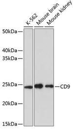 CD9 Antibody in Western Blot (WB)