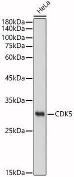 CDK5 Antibody in Western Blot (WB)