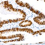 CDX2 Antibody in Immunohistochemistry (Paraffin) (IHC (P))