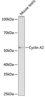 Cyclin A2 Antibody in Western Blot (WB)