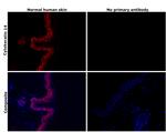 Cytokeratin 14 Antibody in Immunohistochemistry (Paraffin) (IHC (P))