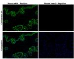 Cytokeratin 14 Antibody in Immunohistochemistry (Paraffin) (IHC (P))