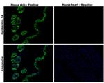 Cytokeratin 14 Antibody in Immunohistochemistry (Paraffin) (IHC (P))