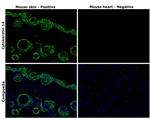 Cytokeratin 14 Antibody in Immunohistochemistry (Paraffin) (IHC (P))