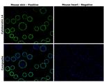 Cytokeratin 14 Antibody