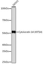 Cytokeratin 14 Antibody in Western Blot (WB)