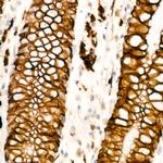 Cytokeratin 20 Antibody in Immunohistochemistry (Paraffin) (IHC (P))