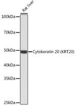 Cytokeratin 20 Antibody in Western Blot (WB)