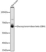 GBA Antibody in Western Blot (WB)