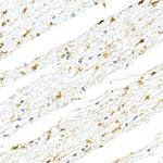 GFAP Antibody in Immunohistochemistry (Paraffin) (IHC (P))