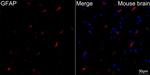 GFAP Antibody in Immunohistochemistry (Paraffin) (IHC (P))