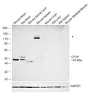 GFAP Antibody in Western Blot (WB)