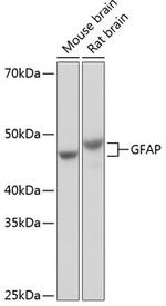 GFAP Antibody in Western Blot (WB)