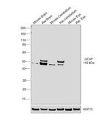 GFAP Antibody in Western Blot (WB)