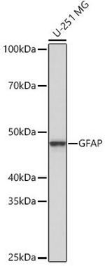 GFAP Antibody in Western Blot (WB)