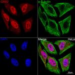 GRB2 Antibody in Immunocytochemistry (ICC/IF)