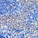 GRB2 Antibody in Immunohistochemistry (Paraffin) (IHC (P))