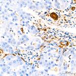 GSTP1 Antibody in Immunohistochemistry (Paraffin) (IHC (P))