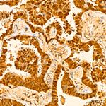 GSTP1 Antibody in Immunohistochemistry (Paraffin) (IHC (P))