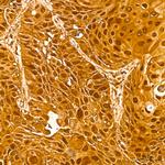 GSTP1 Antibody in Immunohistochemistry (Paraffin) (IHC (P))