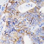 ITGA2 Antibody in Immunohistochemistry (Paraffin) (IHC (P))