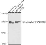 ITGA2 Antibody in Western Blot (WB)