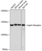 Leptin Receptor Antibody in Western Blot (WB)