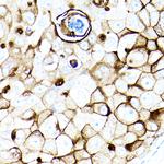 MUC1 Antibody in Immunohistochemistry (Paraffin) (IHC (P))