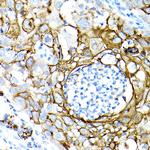 MUC1 Antibody in Immunohistochemistry (Paraffin) (IHC (P))