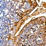 MUC1 Antibody in Immunohistochemistry (Paraffin) (IHC (P))