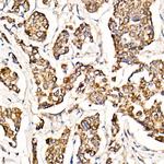 MyD88 Antibody in Immunohistochemistry (Paraffin) (IHC (P))