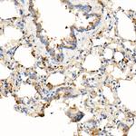 MyD88 Antibody in Immunohistochemistry (Paraffin) (IHC (P))