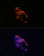 NEFM Antibody in Immunocytochemistry (ICC/IF)