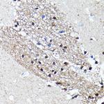 NMDAR2A Antibody in Immunohistochemistry (Paraffin) (IHC (P))