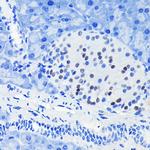 PAX6 Antibody in Immunohistochemistry (Paraffin) (IHC (P))