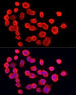 PGP9.5 Antibody in Immunocytochemistry (ICC/IF)