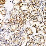 PGP9.5 Antibody in Immunohistochemistry (Paraffin) (IHC (P))