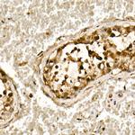 SMAD3 Antibody in Immunohistochemistry (Paraffin) (IHC (P))