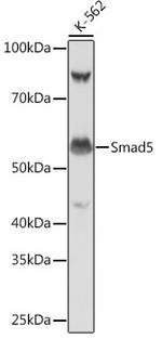 SMAD5 Antibody in Western Blot (WB)