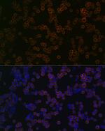 TLR2 Antibody in Immunocytochemistry (ICC/IF)