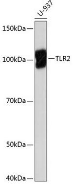 TLR2 Antibody in Western Blot (WB)