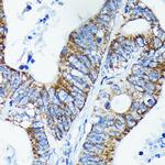 TNFAIP3 Antibody in Immunohistochemistry (Paraffin) (IHC (P))