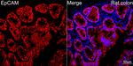 EpCAM Antibody in Immunohistochemistry (Paraffin) (IHC (P))