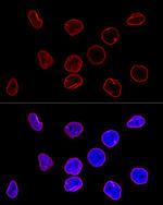 Lamin A/C Antibody in Immunocytochemistry (ICC/IF)