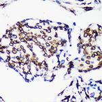 Lamin A/C Antibody in Immunohistochemistry (Paraffin) (IHC (P))