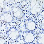 HIF-1 beta Antibody in Immunohistochemistry (Paraffin) (IHC (P))