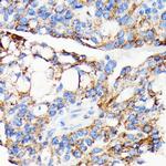 AIF Antibody in Immunohistochemistry (Paraffin) (IHC (P))