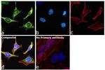 TSC2 Antibody in Immunocytochemistry (ICC/IF)