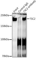 TSC2 Antibody in Immunoprecipitation (IP)