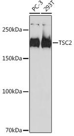 TSC2 Antibody in Western Blot (WB)